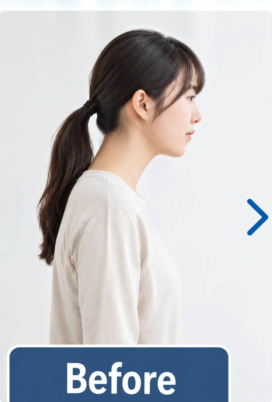 施術前の姿勢（Before）